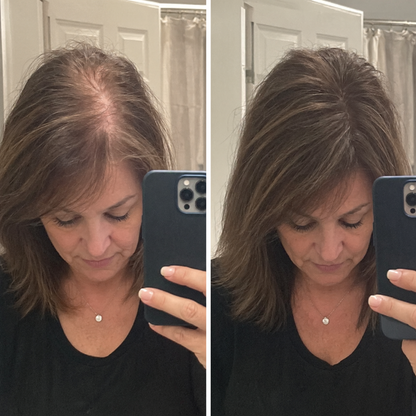 ENZARA Hair Growth Vitamins